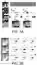 Fig. 04 - Systems and methods for the identification of perivascular spaces in magnetic resonance imaging (MRI)