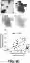 Fig. 06 - Systems and methods for the identification of perivascular spaces in magnetic resonance imaging (MRI)