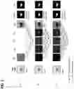 Fig. 09 - Systems, methods, and apparatuses for implementing a multi-resolution neural network for use with imaging intensive applications including medical imaging