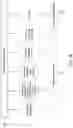Fig. 16 - Systems and methods for detecting and reporting anomalies in utility meters