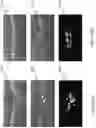 Fig. 11 - Multivariate and multi-resolution retinal image anomaly detection system