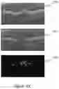 Fig. 12 - Multivariate and multi-resolution retinal image anomaly detection system