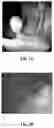 Fig. 02 - System and method for detection of suspicious tissue regions in an endoscopic procedure