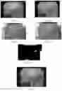 Fig. 08 - System and method for detection of suspicious tissue regions in an endoscopic procedure