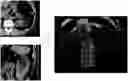 Fig. 01 - Method of segmenting a 3D object in a medical radiation image