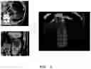 Fig. 03 - Method of segmenting a 3D object in a medical radiation image