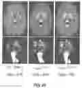 Fig. 06 - 3D segmentation with exponential logarithmic loss for highly unbalanced object sizes
