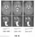 Fig. 07 - 3D segmentation with exponential logarithmic loss for highly unbalanced object sizes