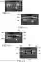 Fig. 04 - Method and apparatus for evaluating a vehicle travel surface