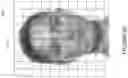 Fig. 12 - Expression transfer across telecommunications networks