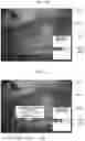 Fig. 18 - Method of operating measurement device, measurement device, and recording medium