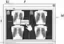 Fig. 01 - Image display apparatus and radiation imaging system