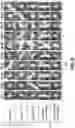 Fig. 09 - Method and apparatus for detection and visualization of pulmonary embolism