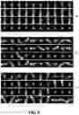 Fig. 10 - Method and apparatus for detection and visualization of pulmonary embolism