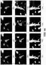 Fig. 11 - Method and apparatus for detection and visualization of pulmonary embolism