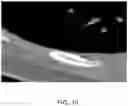 Fig. 11 - Systems and methods for displaying a medical image