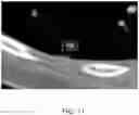 Fig. 12 - Systems and methods for displaying a medical image