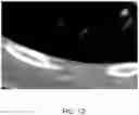 Fig. 13 - Systems and methods for displaying a medical image