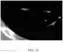 Fig. 14 - Systems and methods for displaying a medical image