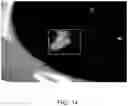 Fig. 15 - Systems and methods for displaying a medical image