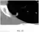 Fig. 16 - Systems and methods for displaying a medical image