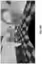 Fig. 35 - Real-time system and method for rendering stereoscopic panoramic images