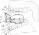 Fig. 01 - Vocalization appliance for assisting vocal cord closure training
