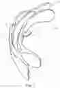 Fig. 02 - Vocalization appliance for assisting vocal cord closure training