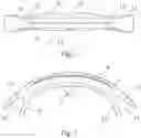 Fig. 03 - Vocalization appliance for assisting vocal cord closure training