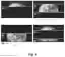 Fig. 05 - Light emitting display device and driving method thereof