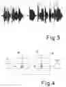 Fig. 03 - Auto-generated accompaniment from singing a melody