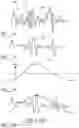 Fig. 11 - Music context system and method of real-time synchronization of musical content having regard to musical timing