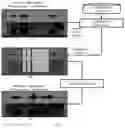 Fig. 05 - Method and system for improving recognition of disordered speech