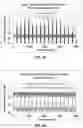 Fig. 08 - System and method for relative enhancement of vocal utterances in an acoustically cluttered environment