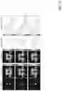 Fig. 41 - Deep learning based dosed prediction for treatment planning and quality assurance in radiation therapy