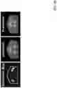 Fig. 45 - Deep learning based dosed prediction for treatment planning and quality assurance in radiation therapy
