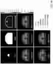Fig. 53 - Deep learning based dosed prediction for treatment planning and quality assurance in radiation therapy