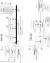 Fig. 09 - Dose volume histogram and dose distribution based autoplanning