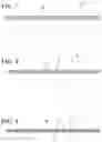 Fig. 06 - Coaxial cable and method of construction thereof