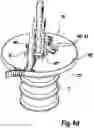 Fig. 13 - Contamination protection for high-voltage insulators