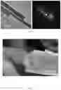Fig. 05 - Linear porous lithium titanate material, preparation and product thereof