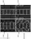 Fig. 08 - CONTACTLESS AIR-FILLED SUBSTRATE INTEGRATED WAVEGUIDE DEVICES AND METHODS