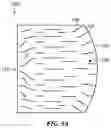 Fig. 10 - Electronic device with segmented housing having molded splits