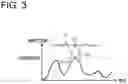 Fig. 04 - Peak suppression circuit, peak suppression method, and transmitter