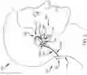Fig. 04 - Arm for napeband-style earphone system