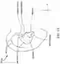 Fig. 02 - Earpiece tip and related earpiece