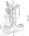 Fig. 03 - Earpiece tip and related earpiece