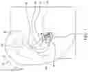 Fig. 05 - Earpiece tip and related earpiece