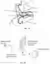 Fig. 02 - Acoustic dampening compensation system