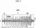 Fig. 09 - SYSTEM AND METHOD FOR DETECTING SOUND IN VEHICLE